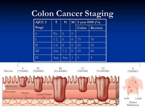 However, there is no strong evidence that all patients with stage II colon cancer will achieve the same benefit. . Pt4a colon cancer prognosis